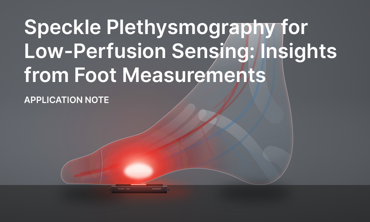 Featured image for “Speckle Plethysmography for Low-Perfusion Sensing: Insights from Foot Measurements”